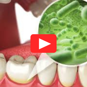 Up next dentes imagem